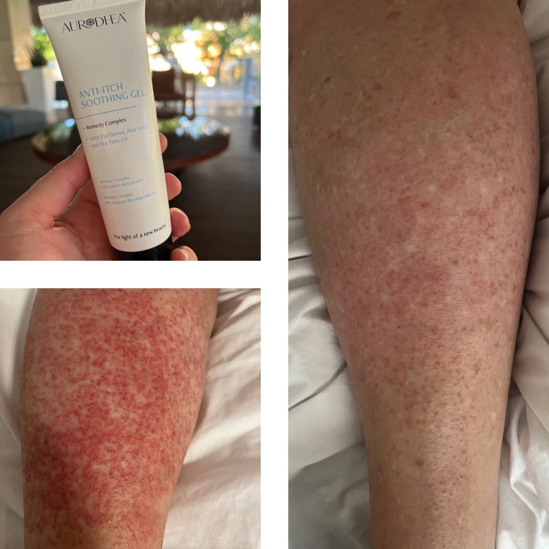 Gel apaisant anti-démangeaison - 75 ml, vue 3